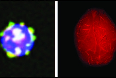 Left: T and B cells are types of white blood cells that develop from stem cells (progenitor cells) in the bone marrow. When HDL (good cholesterol) containing the protein ApoM (in yellow) binds to the surface of their progenitor cells, it prevents them from proliferating. Right: Mice that lack the ApoM protein on their HDL develop more severe brain inflammation in a mouse model of multiple sclerosis. This inflammation is illustrated by leakage of a red fluorescent dye from blood vessels into the brain. Image
